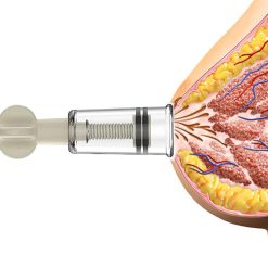 6107RetCE6L. AC SL1500