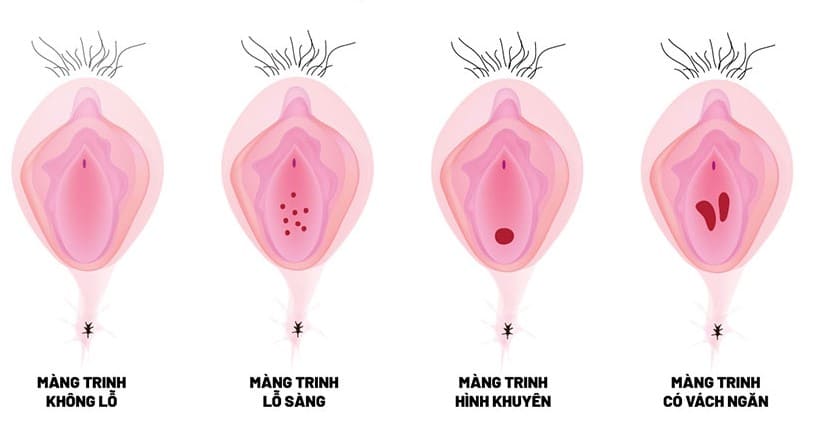 mang trinh co mau trang duc 3