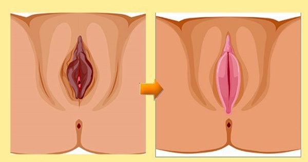 cach lam se khit vung kin 1