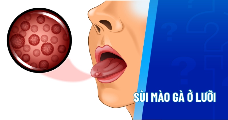sui mao ga o luoi