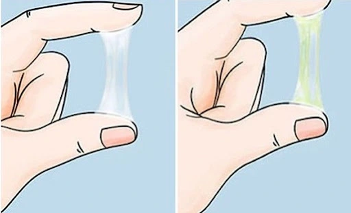 Sắp có kinh ra huyết trắng có sao không? Cần làm gì? 6 huyet trang 1