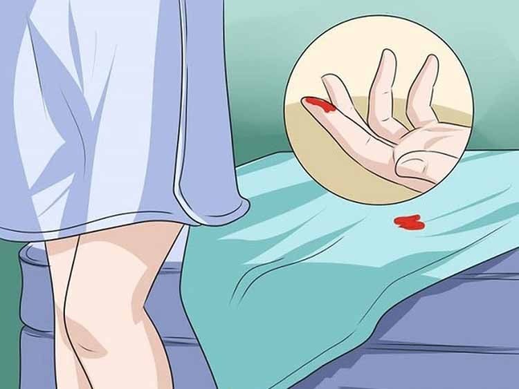 Mất trinh có nguy hiểm không? Có ảnh hưởng đến kinh nguyệt không? 5 rach mang trinh co anh huong den kinh nguyet khong 01