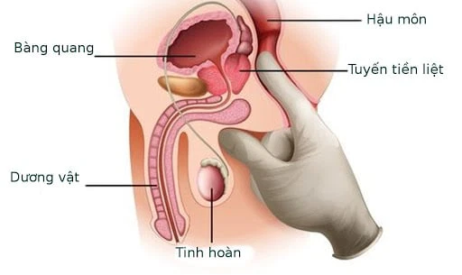 Điểm G của nam giới nằm ở đâu? Cách kích thích điểm G cho nam giới 8 tuyen tien liet