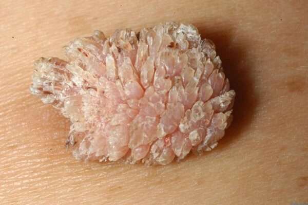 Qzq4DklV9zd4cXvYqM0wumTrI1ivSfH7g7SRvAa rYTi0xU0Co9HEI2ZrN4x16HOjiV75t6Xj8px5go0eT03tZQlSjSA6QhONueNXzqaQjsbeUB1272SBHVge ut1qsqQzmtz0E1ojplOTVPW5A3DSz UZ222a42fd0OYNR8UBokGiva472G48J9zXlNILhJ