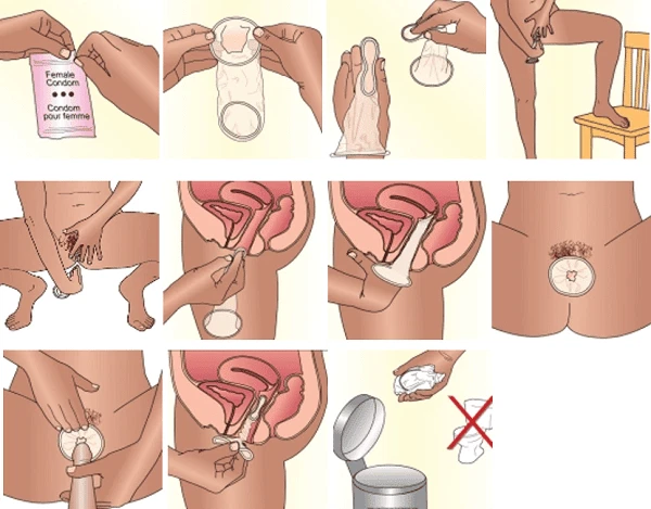 Cách sử dụng bao cao su nữ đúng chuẩn - Hướng dẫn chi tiết 5 bao cao su nu 2 1