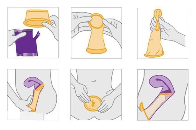 Cách sử dụng bao cao su nữ đúng chuẩn - Hướng dẫn chi tiết 7 cach deo bao cao su nu
