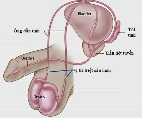 Thắt ống dẫn tinh có ảnh hưởng đến sinh lý không? Xuất tinh được không 5 5f1026dbf4be28f9c05e9ab3 chi phi that ong dan tinh het bao nhieu tien