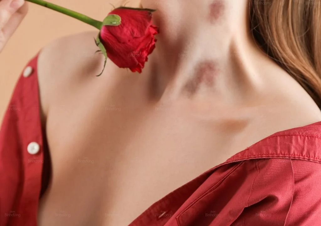 hinh chup ve hickeykiss